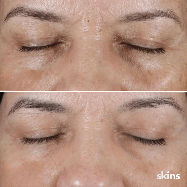 Clienta usando su mascarilla SKINS