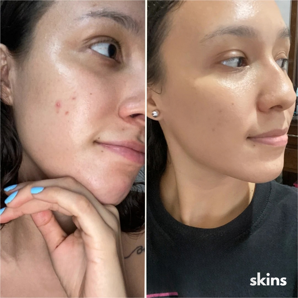Clienta usando su mascarilla SKINS