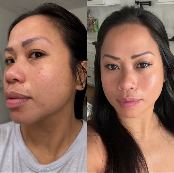 Clienta usando su mascarilla SKINS