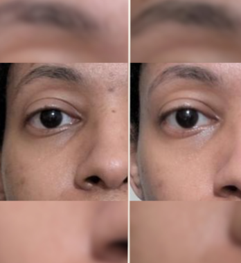 Clienta usando su mascarilla SKINS