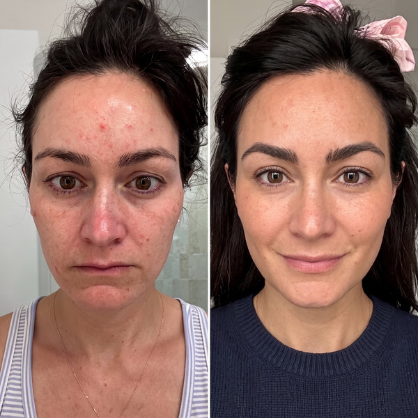 Clienta usando su mascarilla SKINS