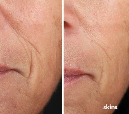 Mascara Led Skins Pro