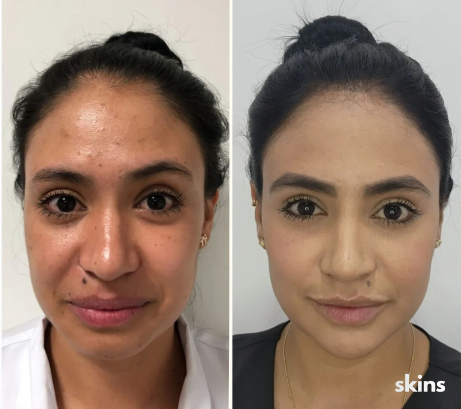 Mascara Led Skins Pro
