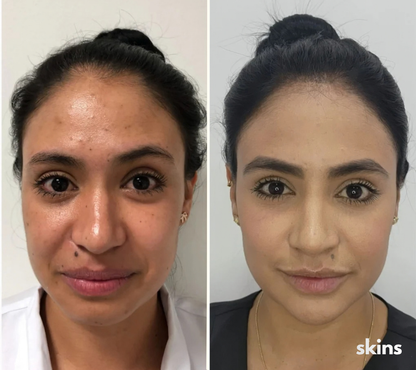 Mascara Led Skins Pro