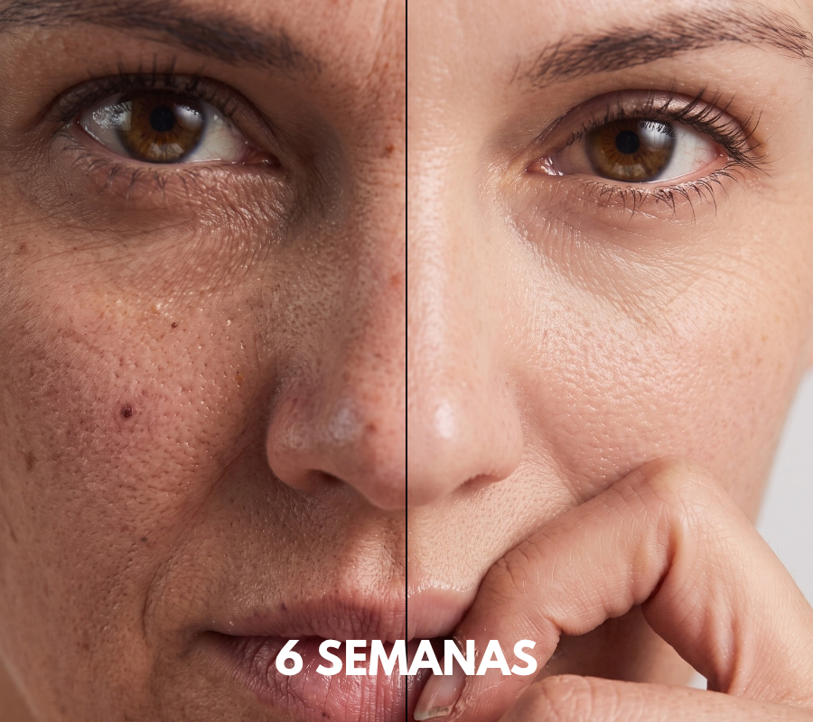Mascara Led Skins Pro