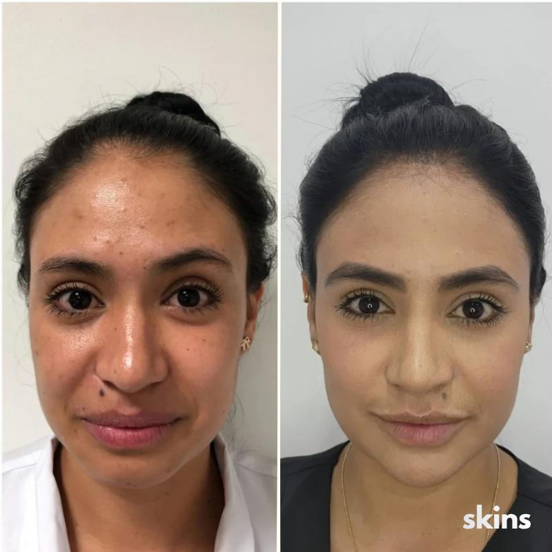 Mascara Silicona Skins Pro