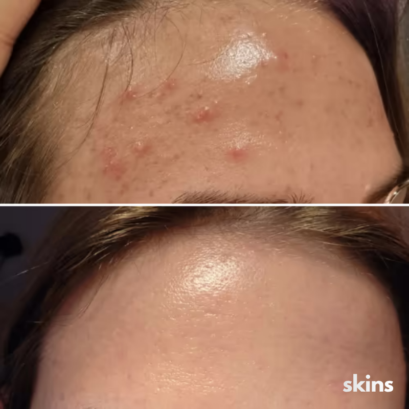 Mascara Silicona Skins Pro